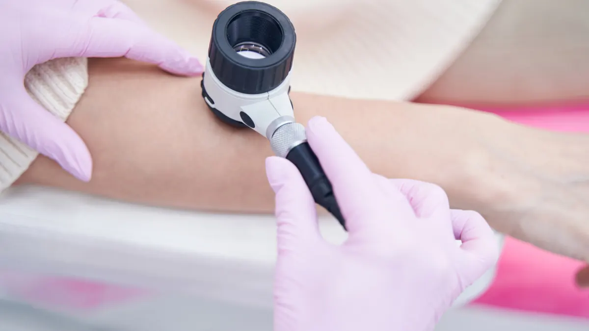 Dermatoscopia: O Que É, Para Que Serve e Quem Deve Fazer