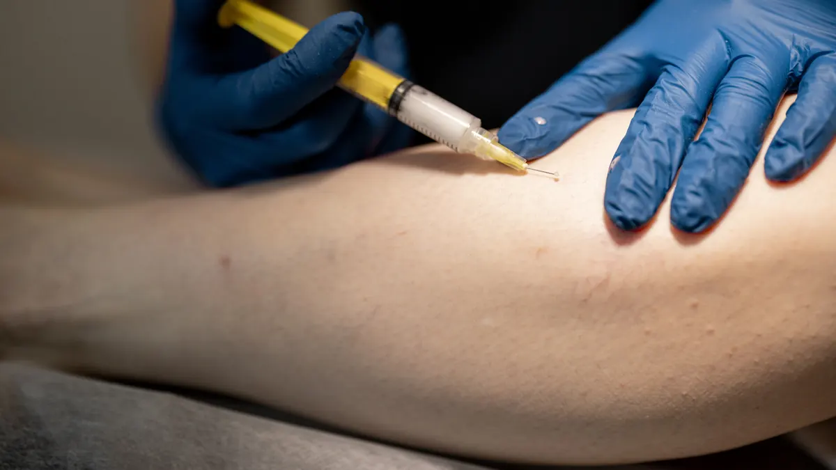 Escleroterapia: Tratamento para Vasinhos e Varizes com Resultados Comprovados