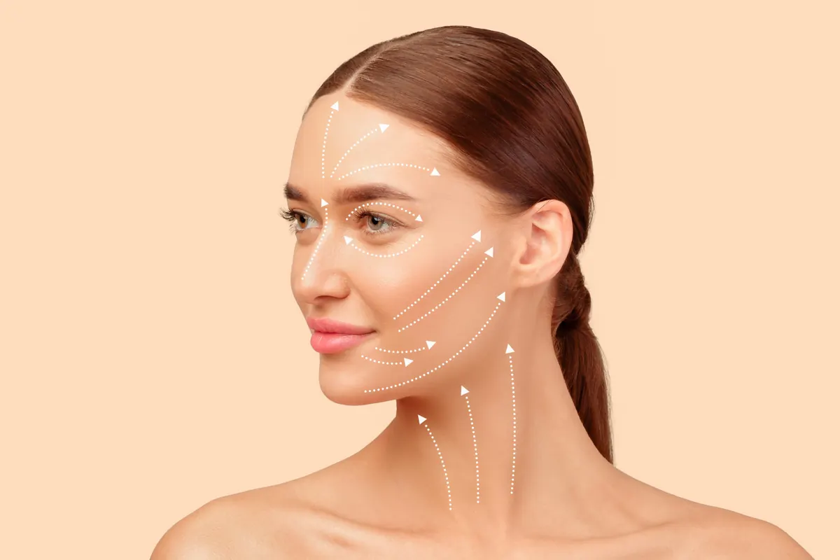 Fios de PDO: Lifting Facial Sem Cirurgia, Como Funciona e Resultados