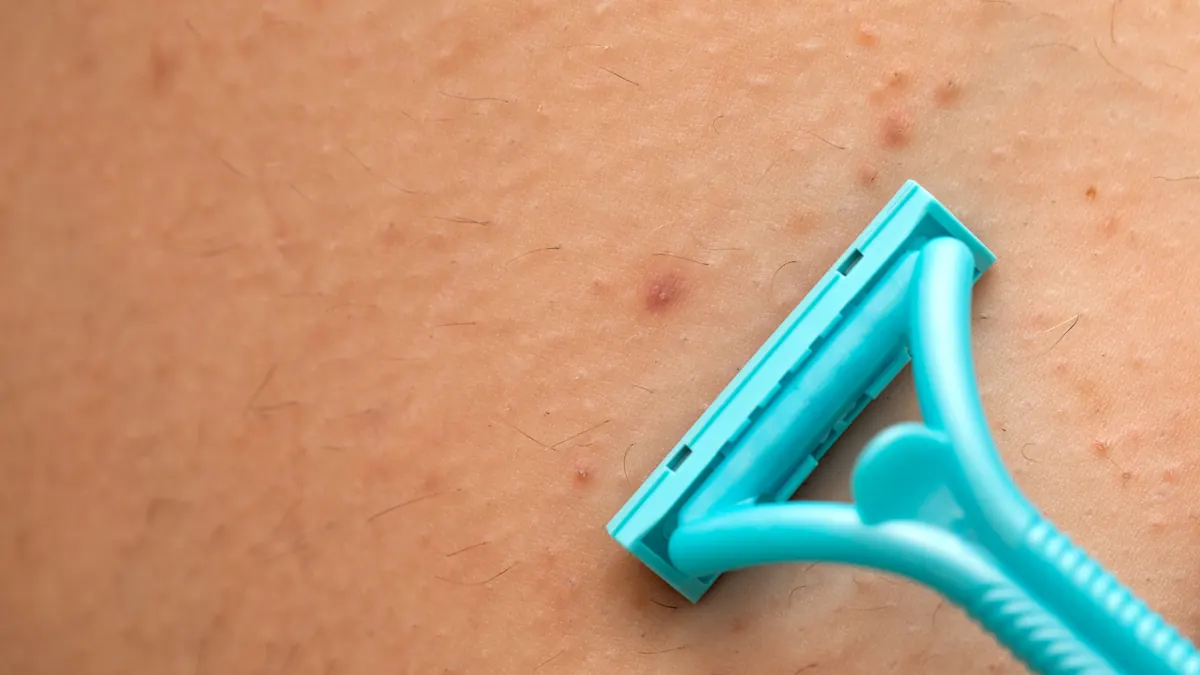 Foliculite: Tipos, Causas, Diagnóstico e Tratamentos Dermatológicos