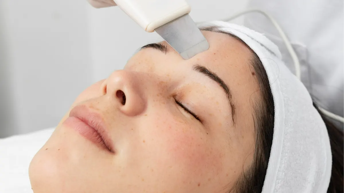 Laser para Melasma: Como Funciona e Resultados Esperados
