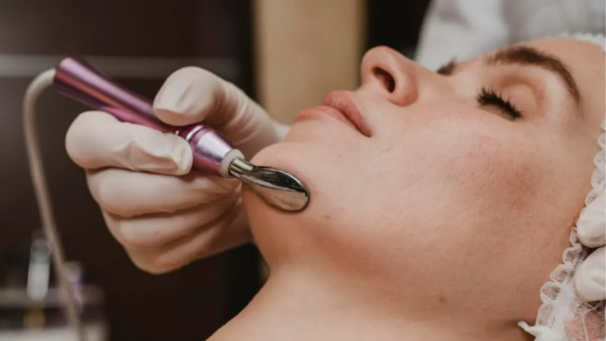 Laser para Melasma: Como Funciona e Resultados Esperados