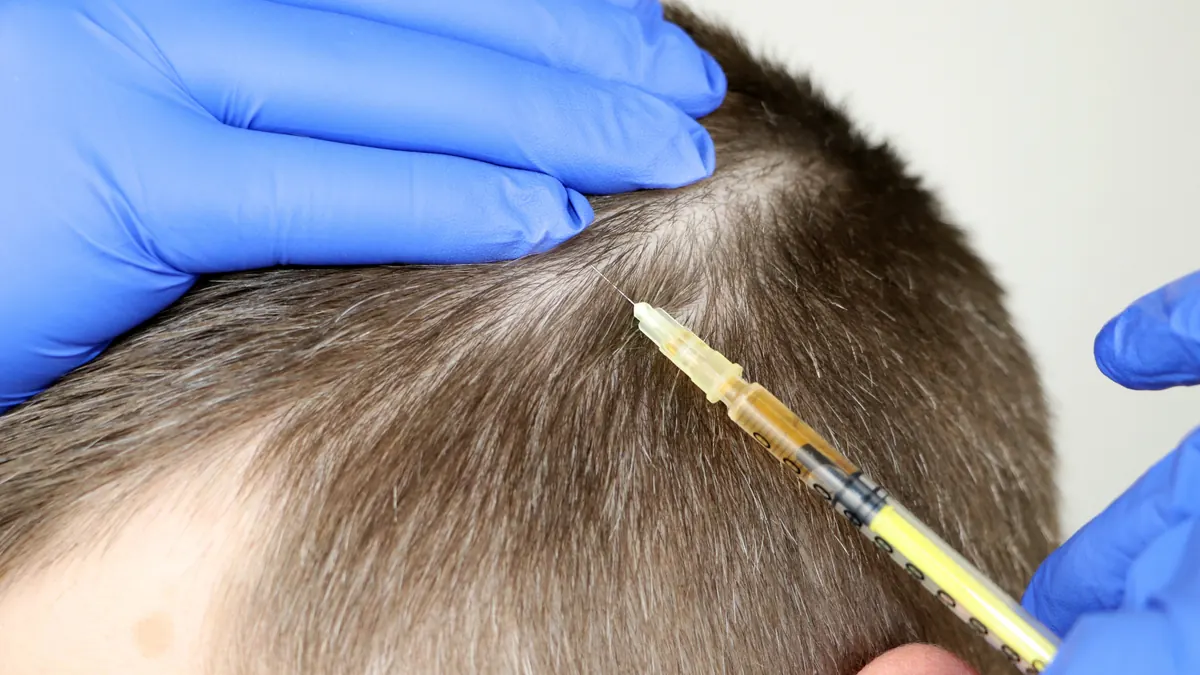 Mesoterapia Capilar: O Que É, Como Funciona e 6 Benefícios