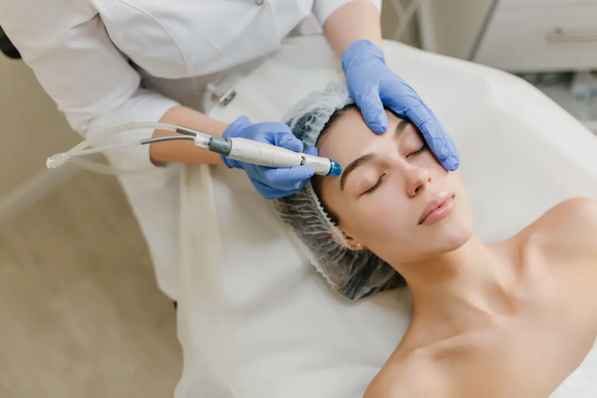 Microagulhamento Facial: Benefícios, Indicações e Cuidados Pós-Procedimento