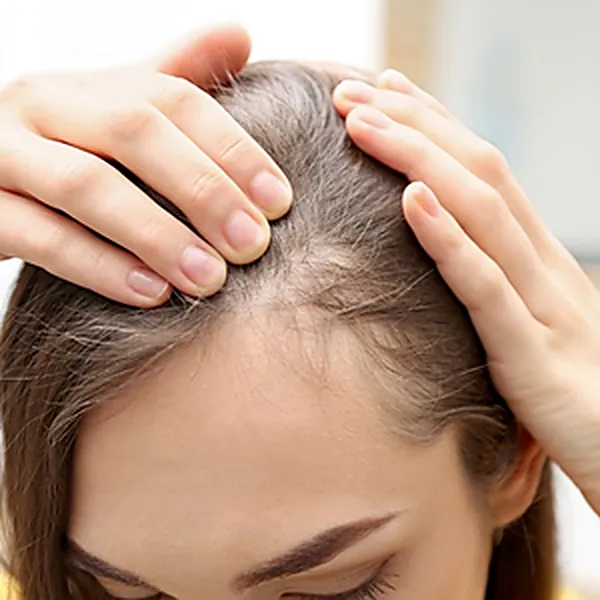 Queda de Cabelo — Dra. Raisa Resende