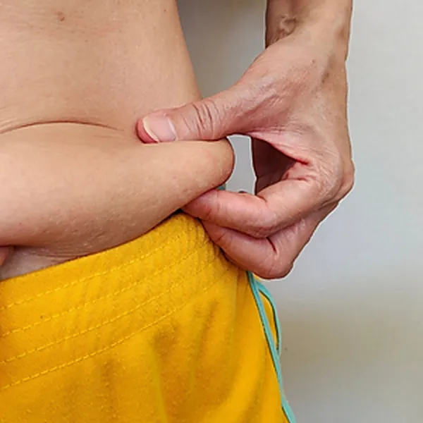 Flacidez Corporal — Dra. Raisa Resende, dermatologista em Franca–SP