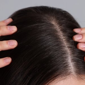 Revitalização do Couro Cabeludo | Dra. Raisa Resende | Dermatologia