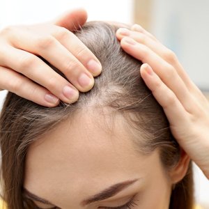 Tratamento de Queda de Cabelo | Dra. Raisa Resende | Dermatologia