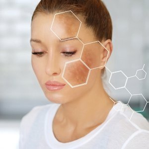 Tratamento de Manchas e Melasma | Dra. Raisa Resende | Dermatologista