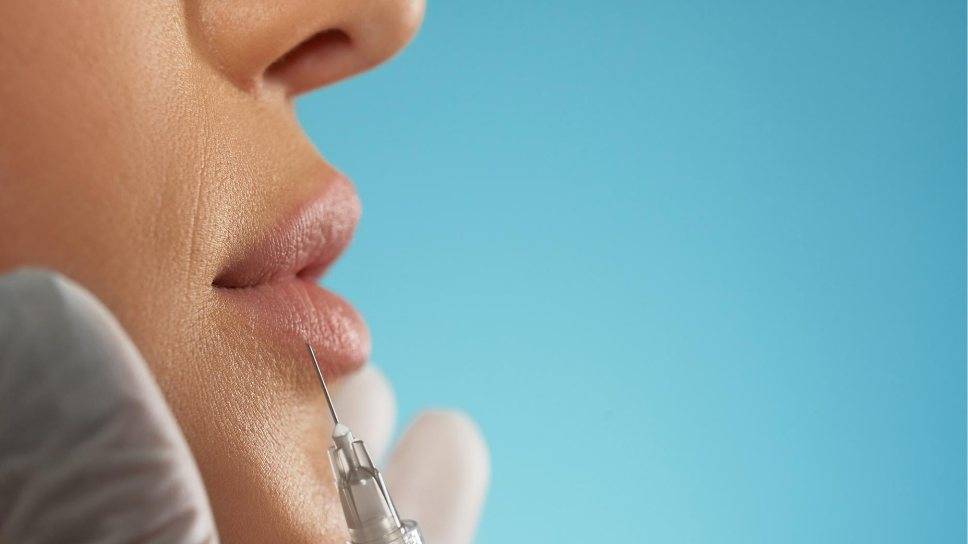 Preenchimento Facial | Dra. Raisa Resende