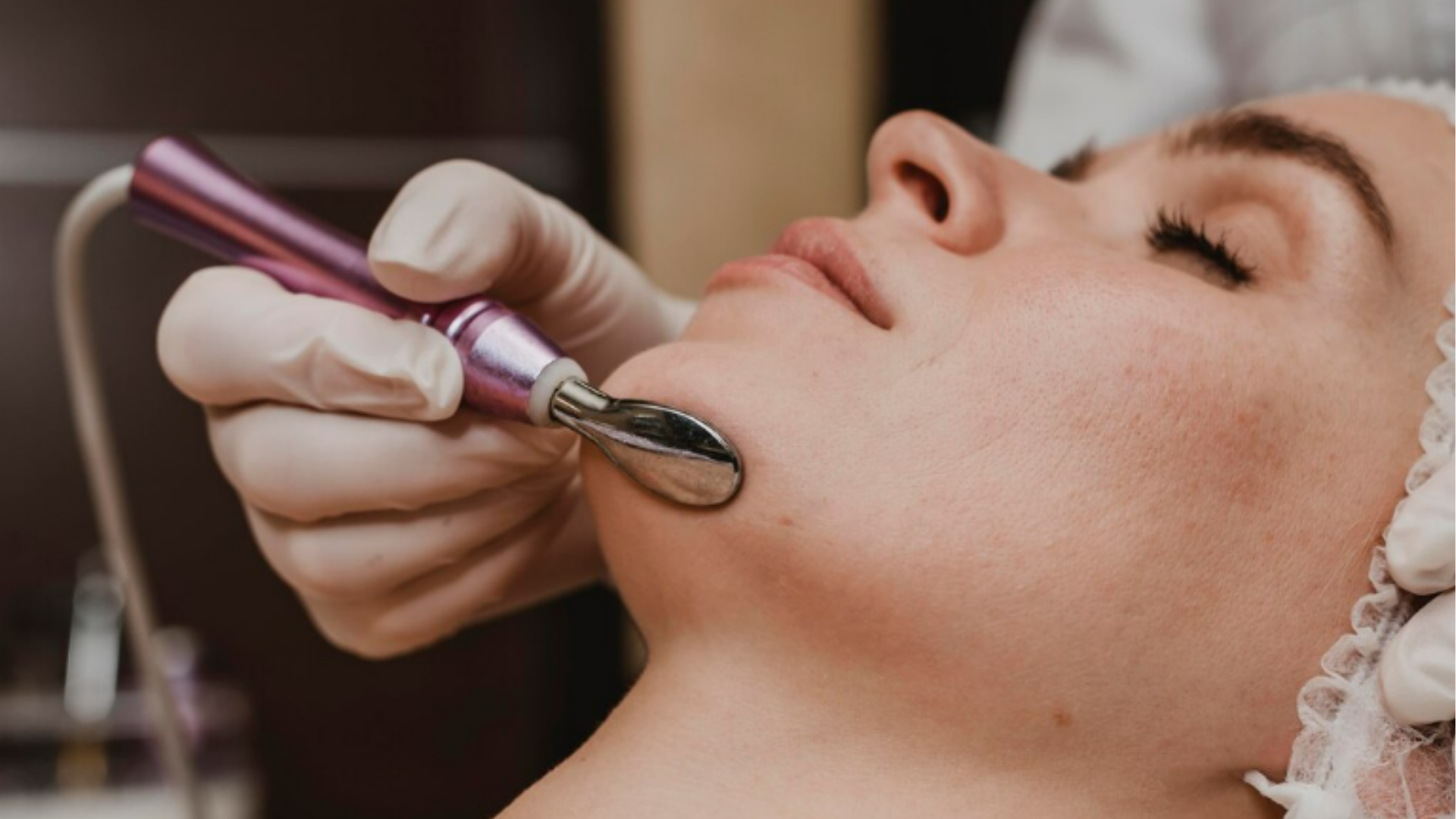 Laser para Melasma | Dra. Raisa Resende