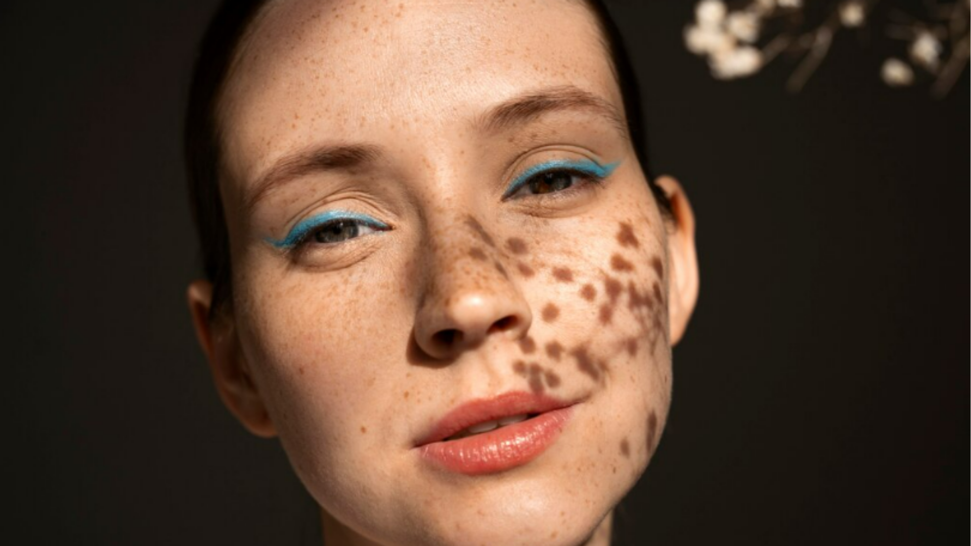 Manchas na Pele | Dra. Raisa Resende